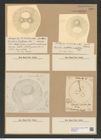 Coscinodiscus excavatus Grev. (de-Toni-Nr.: Genus 202, Species 4988) Zeichnungen Sammlung Grunow Nr. 8604 (NHMW-BOT-W0378264)